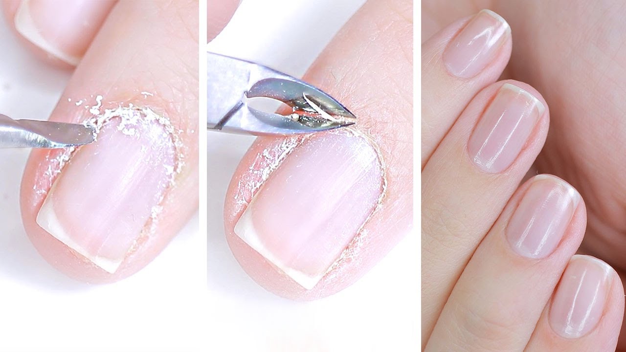 Nail & Cuticle Care