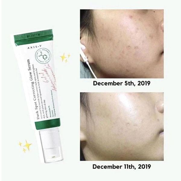 AXIS Y Dark Spot Correcting Glow serum/5ml