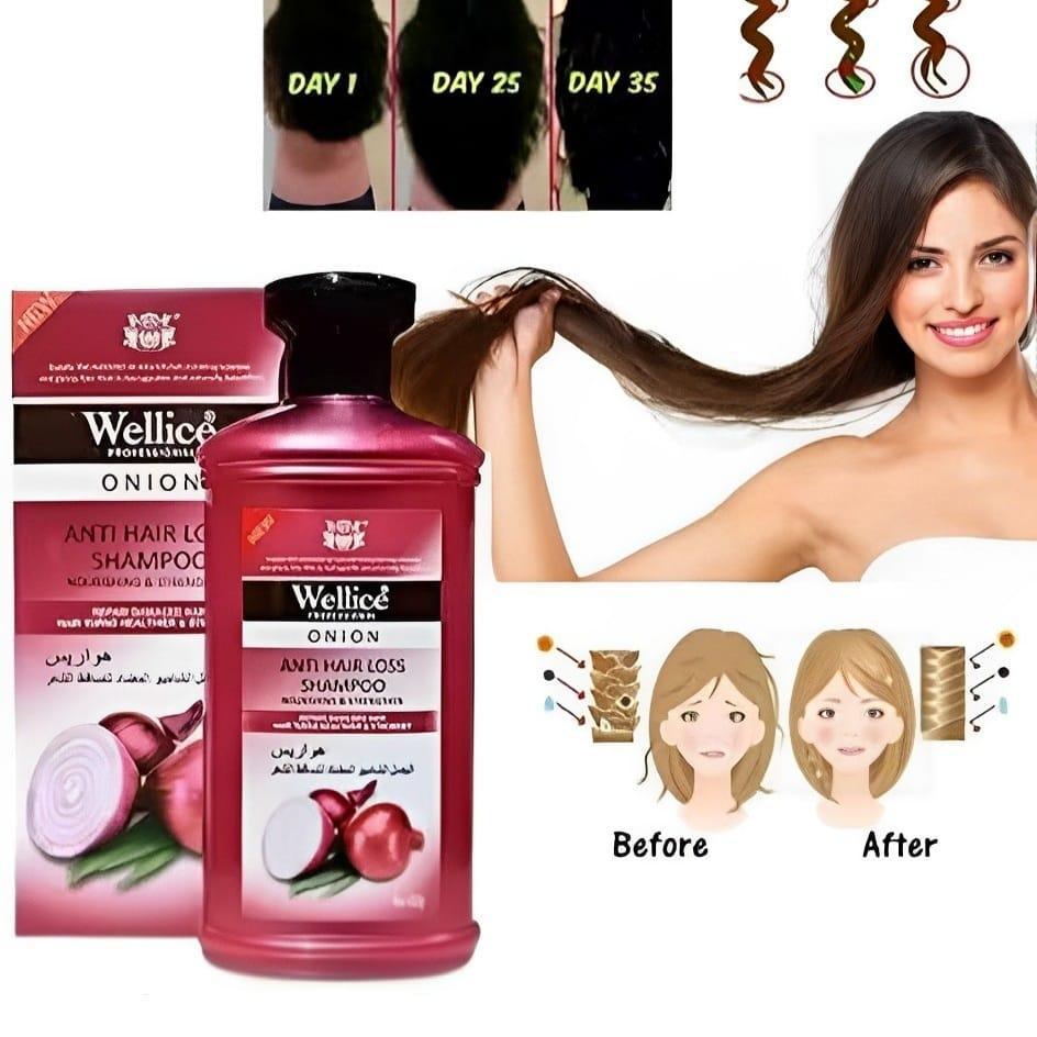 Wellice Onion Anti-Hair Loss Shampoo 400g