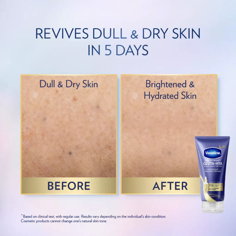 Vaseline Gluta-Hya Serum Burst Lotion Healthy Bright Overnight Radiance Repair 200ml
