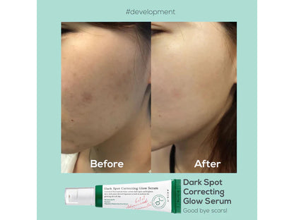 AXIS-Y - Dark Spot Correcting Glow Serum 50ml