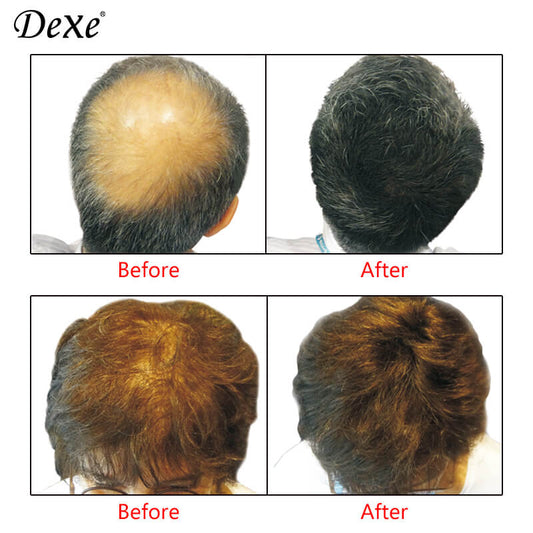 Dexe Hair Building Fibers 22 g with Hair Lock Spray 100 ml Instant Hair Thickening & Long-Lasting Hold