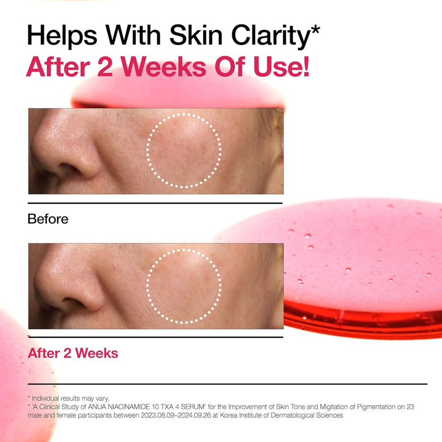 Anua Niacinamide 10% + TXA 4% Serum 30 ml Brightening Care & Dark Spot Correction (K Beauty)