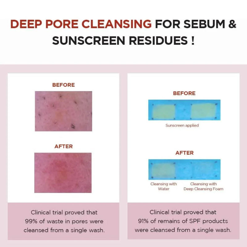 SKIN1004 Madagascar Centella Poremizing Deep Cleansing Foam 125 ml Deep Pore Cleansing & Oil Control (K Beauty)