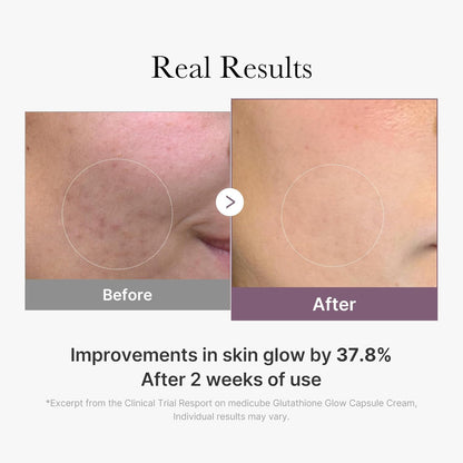 Medicube AGE-R Glutathione Glow Capsule Cream 50 ml Brightening & Anti-Aging Care (K Beauty)