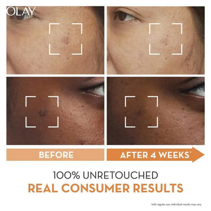Olay Luminous Niacinamide + Vitamin C Super Serum 30ml – Reduces the Look of Dark Spots & Boosts Skin Radiance