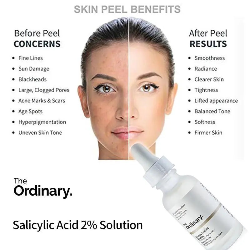 The Ordinary Salicylic Acid 2% Solution 30ml
