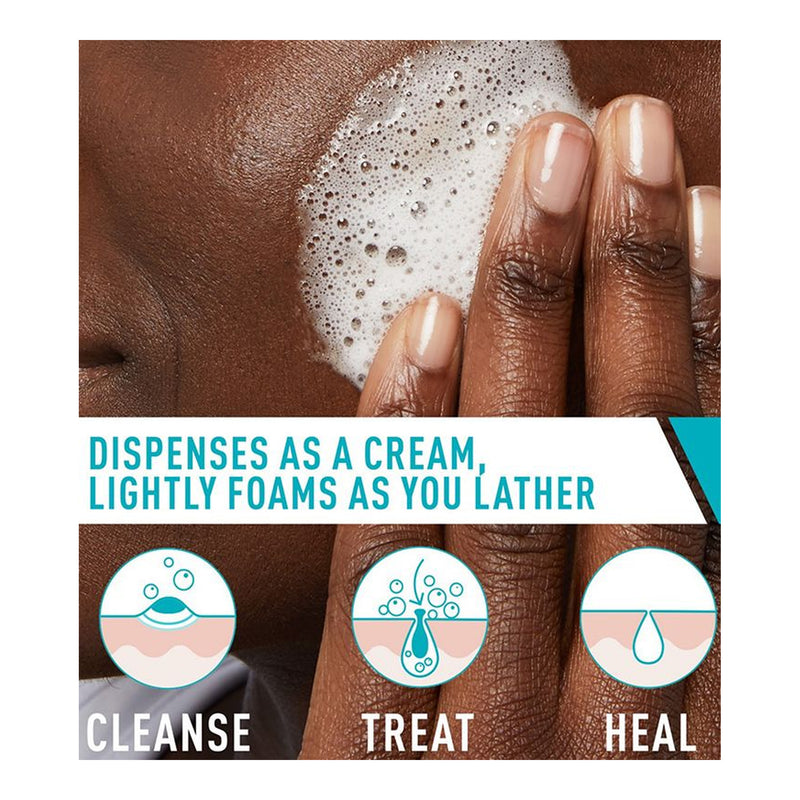 CeraVe Acne Foaming Cream Cleanser 4% benzoyl peroxide USA formula application and lather image