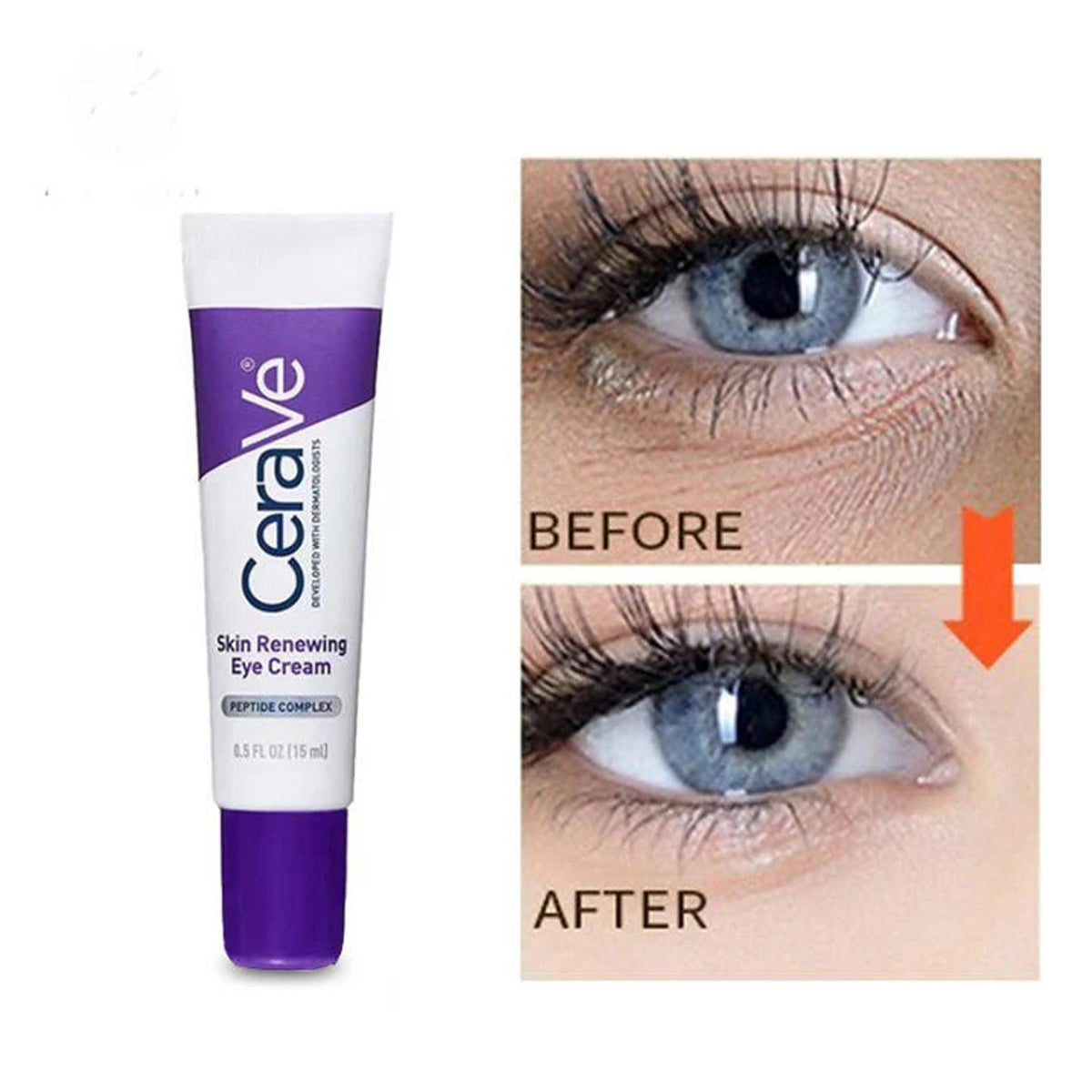 Cerave Skin Renewing Eye Cream 15ml (New Packing) supporting product gallery image
