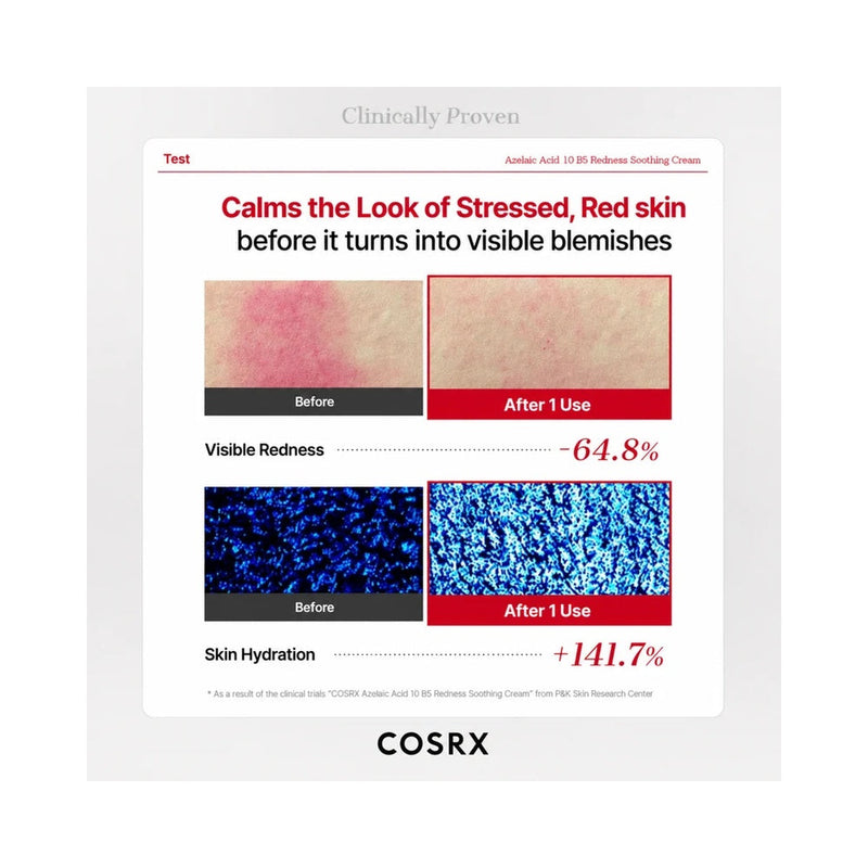 COSRX Azelaic Acid 10 B5 cream clinical results detail