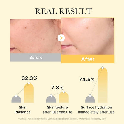 Medicube Kojic Acid Turmeric Brightening Gel Mask (Single Sheet)