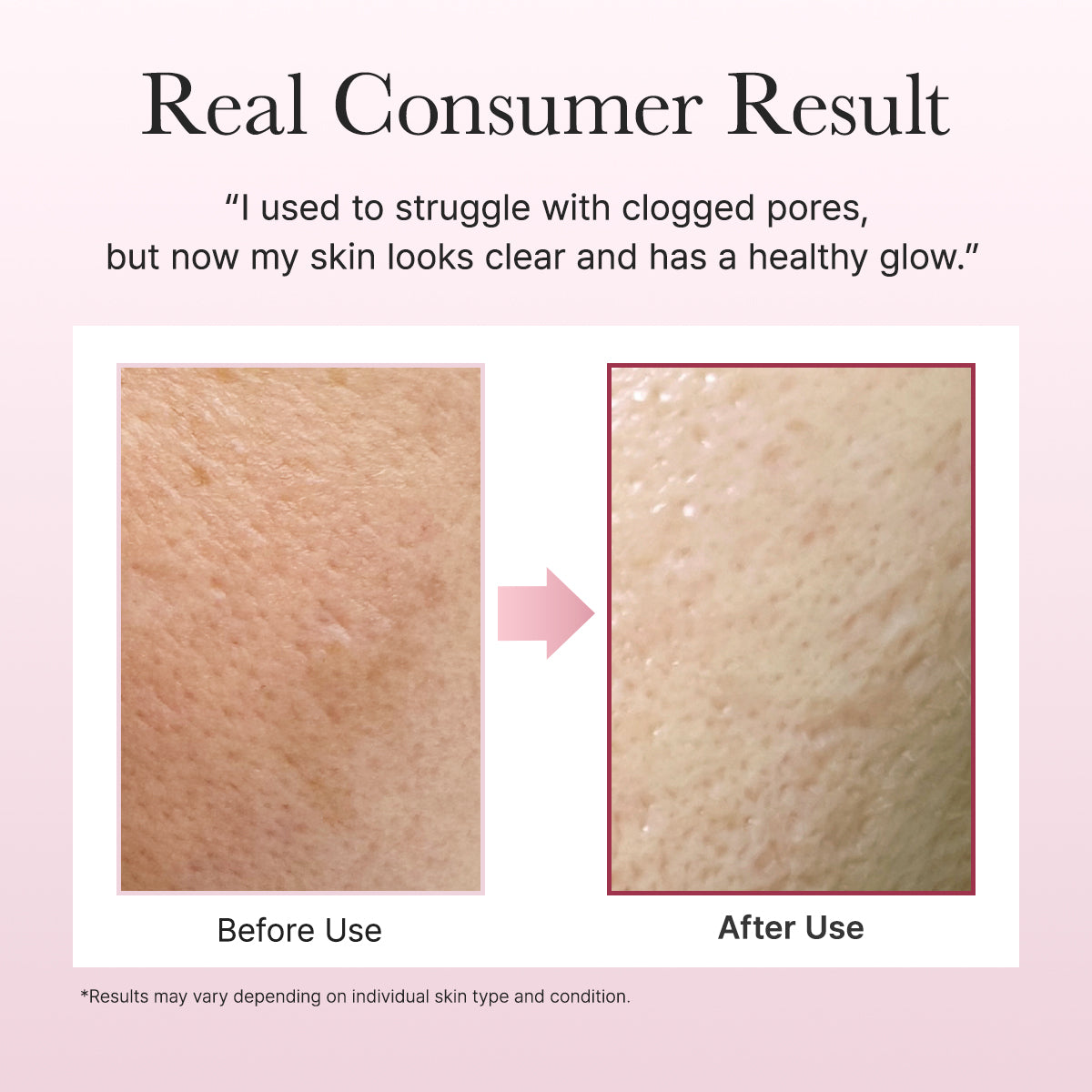 Arencia Fresh Rosehip Rice Mochi Cleanser 120 g Gentle Cleansing & Hydrating Care (K Beauty)