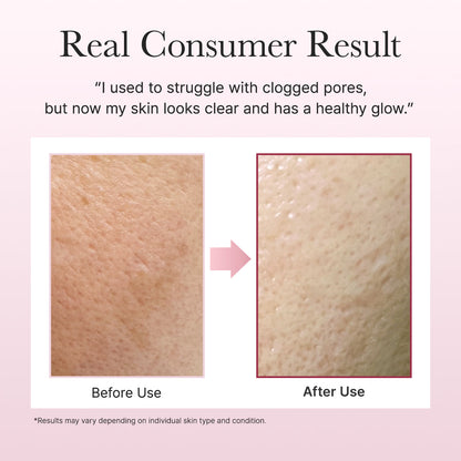 Arencia Fresh Rosehip Rice Mochi Cleanser 120 g Gentle Cleansing & Hydrating Care (K Beauty)