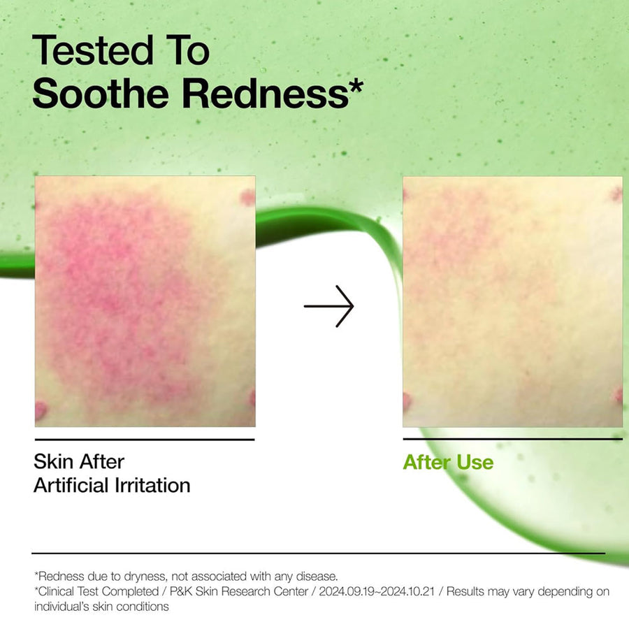Anua Azelaic Acid 10% Hyaluron Redness Soothing Serum 30 ml Calms & Reduces Skin Redness (K Beauty)
