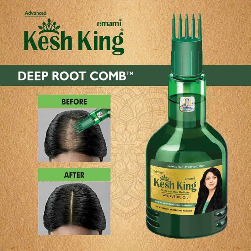 Emami Kesh King Plus 21 Herbs Hair Oil 50ml - Ayurvedic Hair Care Oil for Strong Hair Growth, Hair Fall Control & Healthy Sca