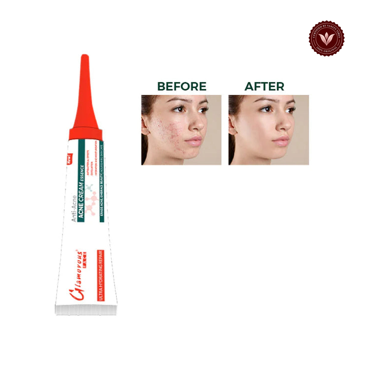 Glamorous Face Anti Acne Cream