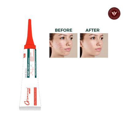 Glamorous Face Anti Acne Cream